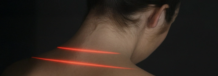 Chiropractic Bakersfield CA Cold Laser Cold laser therapy on the back on a patients neck.